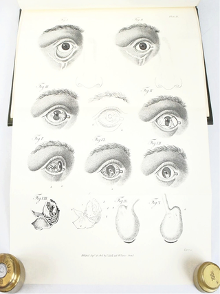 Practical Observations on the Principal Diseases of the Eyes: Illustrated with Cases (Limited, Special Facsimile Edition)